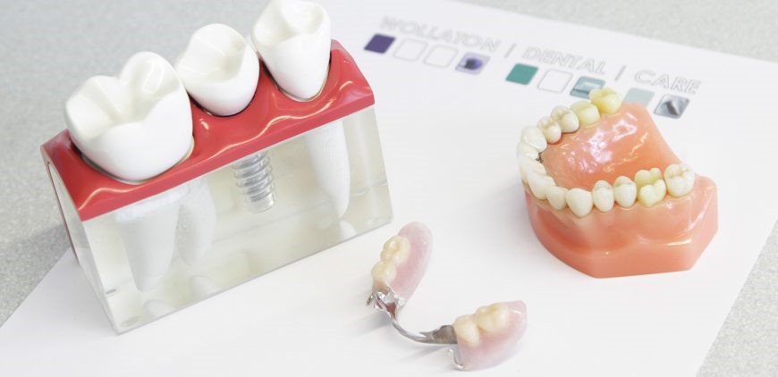 Different Types Of Dentures Uniopolis OH 45888